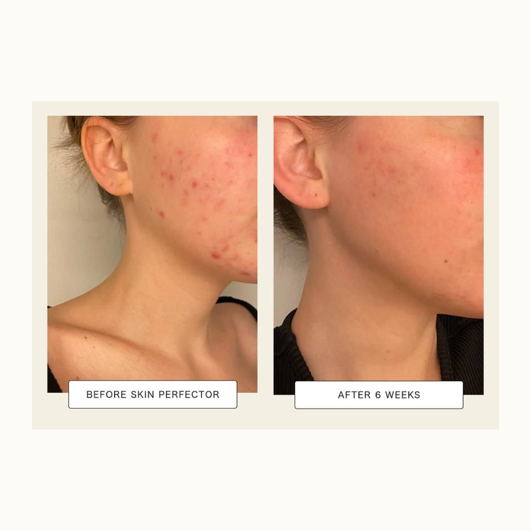 Anti-Imperfection Face Serum 2% BHA